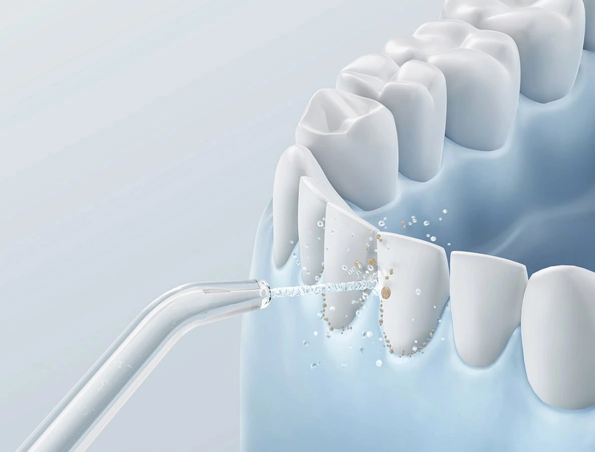 Dental hygienist performing deep cleaning